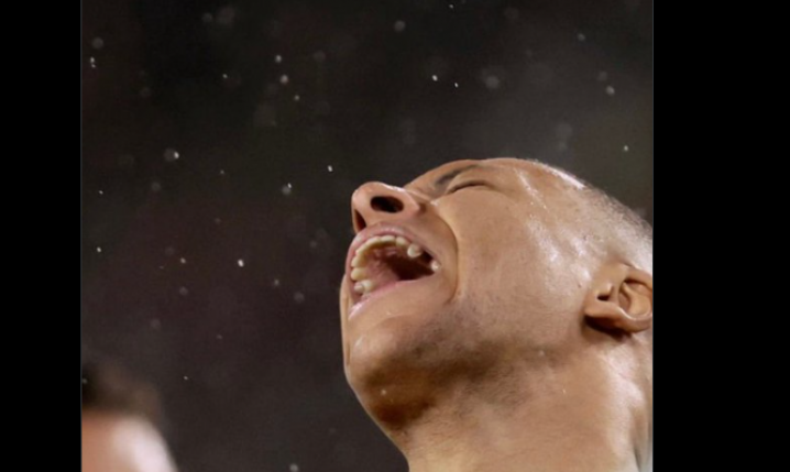 Kylian Mbappe i jego ''ZĄB'' po niedawnym zabiegu!